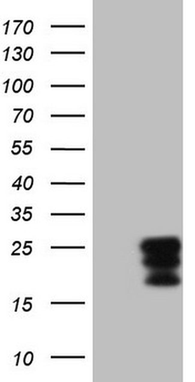 CSF2 Antibody in Western Blot (WB)