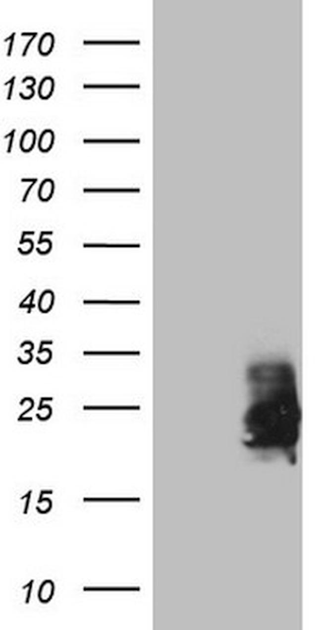 CSF2 Antibody in Western Blot (WB)