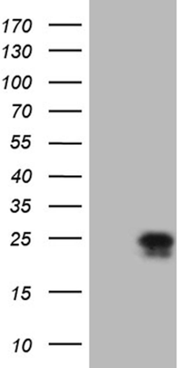 CSF2 Antibody in Western Blot (WB)