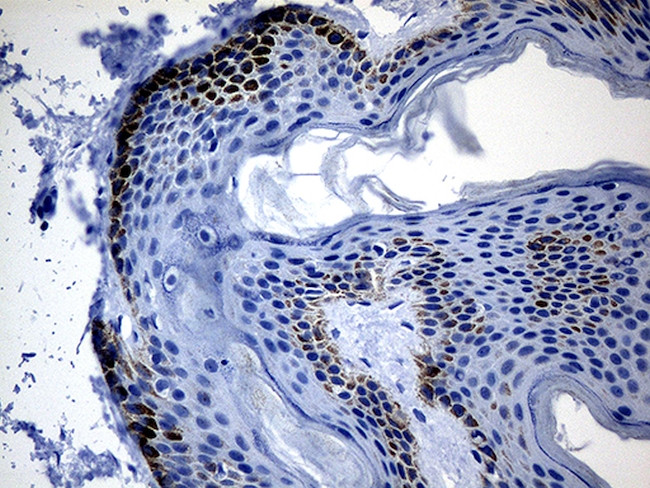 CSF3 Antibody in Immunohistochemistry (Paraffin) (IHC (P))