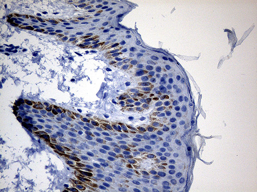 CSF3 Antibody in Immunohistochemistry (Paraffin) (IHC (P))