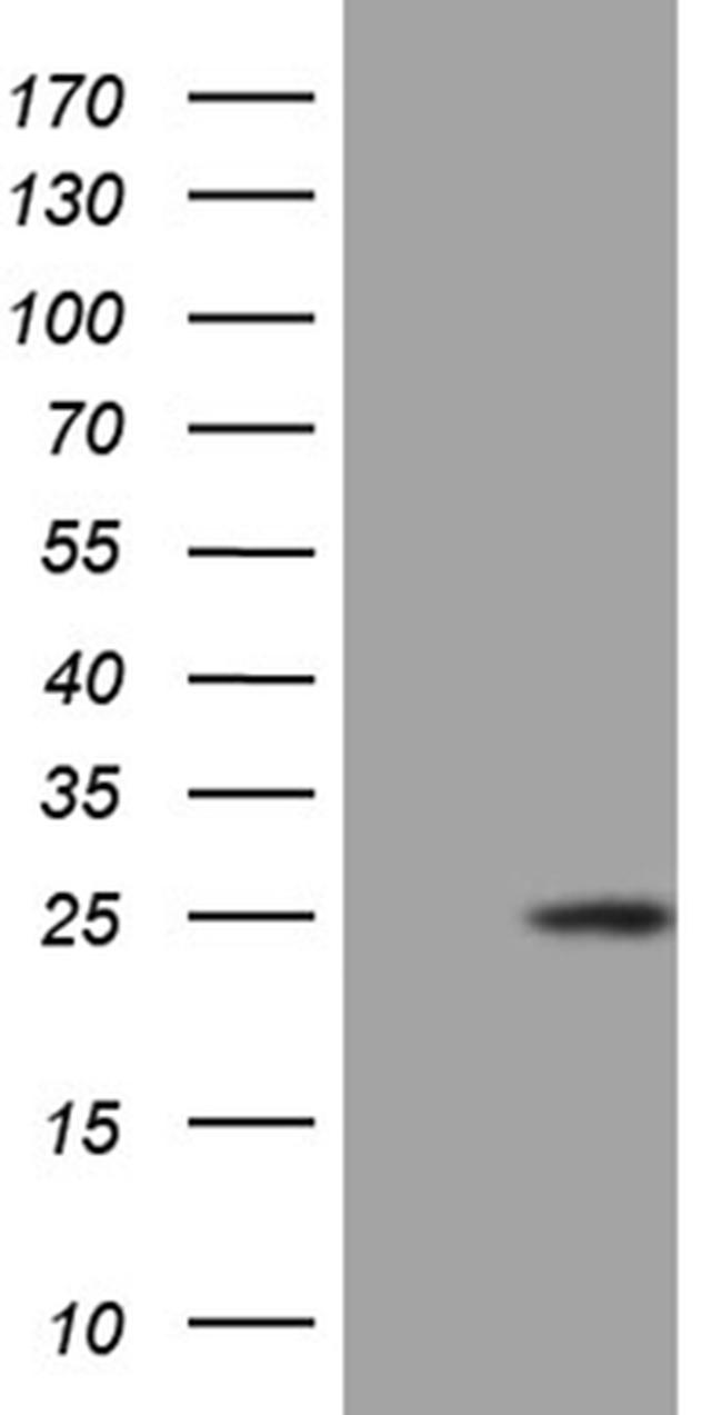 CSF3 Antibody in Western Blot (WB)