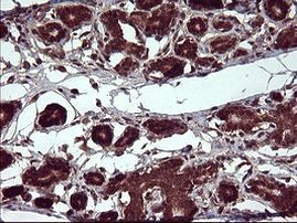 CSH1 Antibody in Immunohistochemistry (Paraffin) (IHC (P))