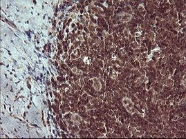 CSH1 Antibody in Immunohistochemistry (Paraffin) (IHC (P))