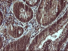 CSH1 Antibody in Immunohistochemistry (Paraffin) (IHC (P))