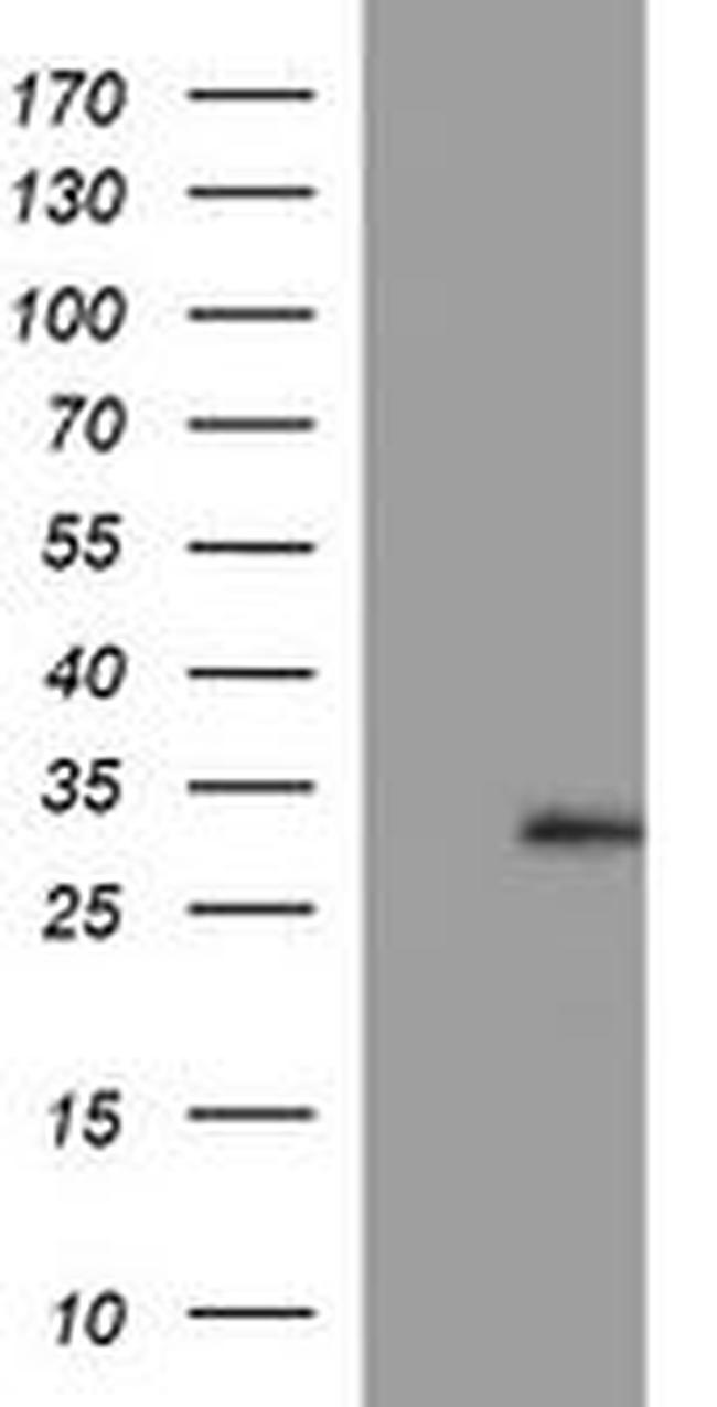 CSH1 Antibody in Western Blot (WB)