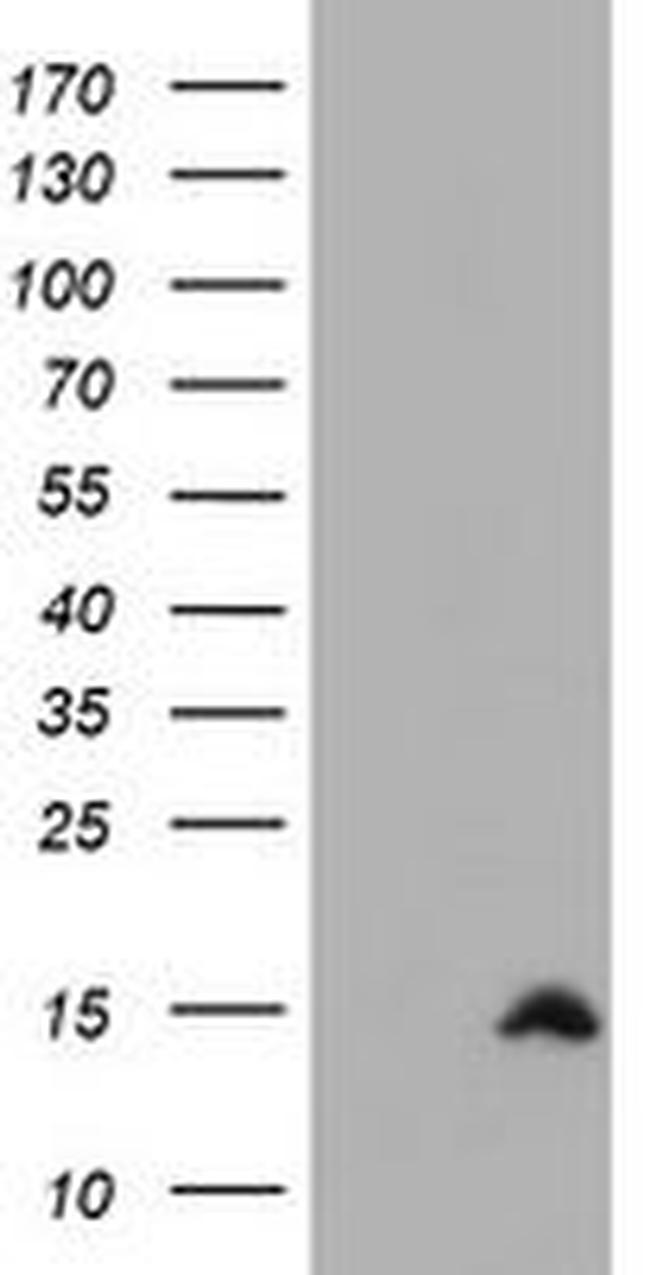CST2 Antibody in Western Blot (WB)