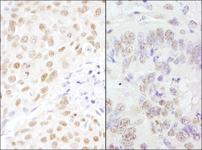 CSTF77 Antibody in Immunohistochemistry (IHC)