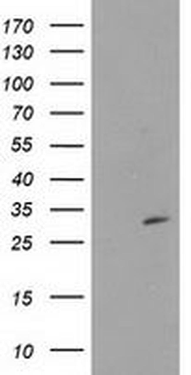 CTDSP1 Antibody in Western Blot (WB)