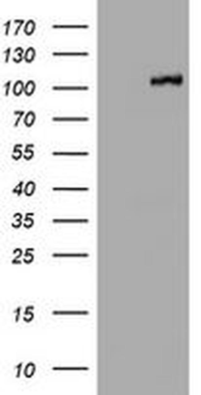 CTNND1 Antibody in Western Blot (WB)