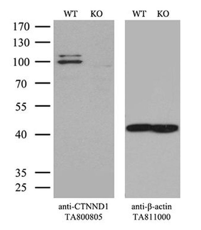 CTNND1 Antibody in Western Blot (WB)