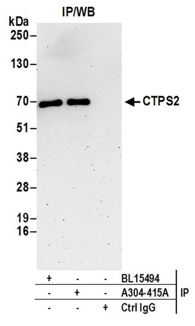 CTPS2 Antibody in Western Blot (WB)