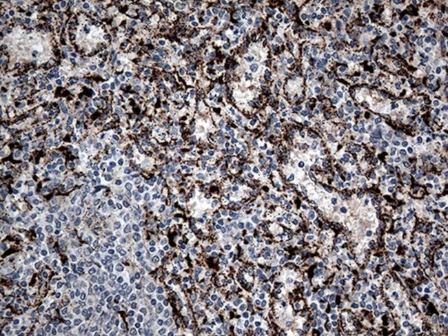 CTSL1 Antibody in Immunohistochemistry (Paraffin) (IHC (P))