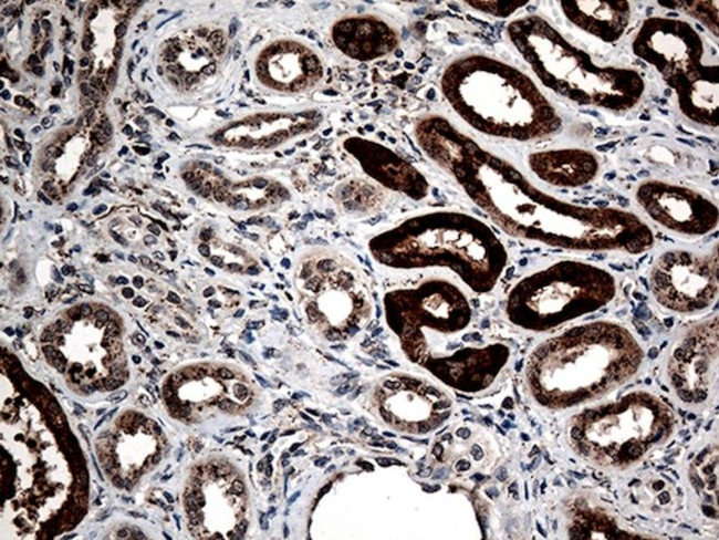 CTSL1 Antibody in Immunohistochemistry (Paraffin) (IHC (P))