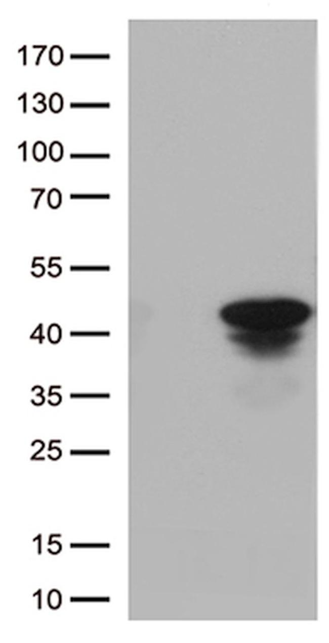 CTSL1 Antibody in Western Blot (WB)