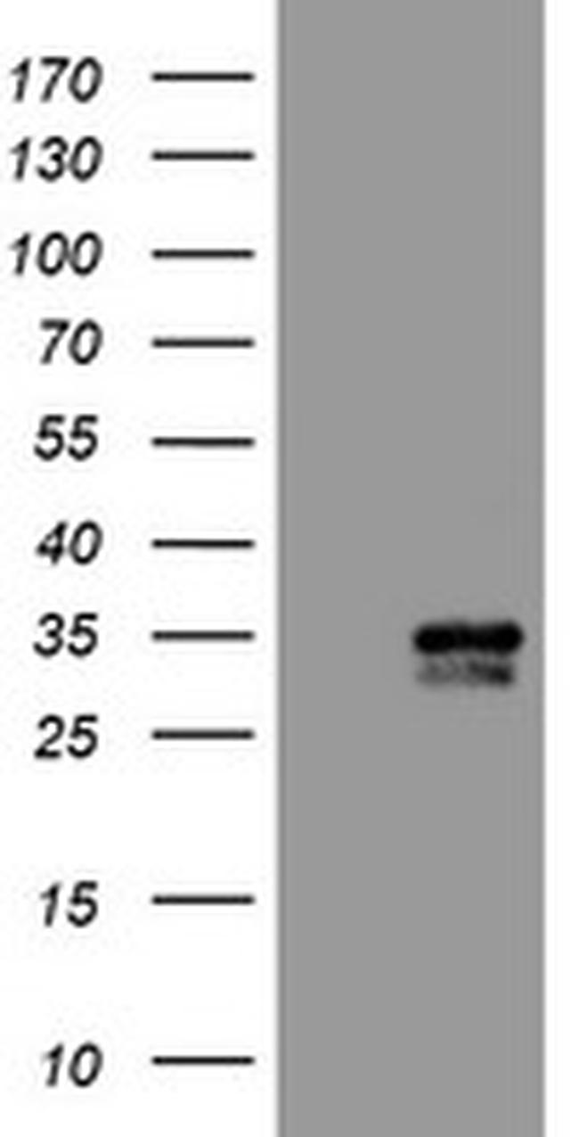 CXorf26 Antibody in Western Blot (WB)