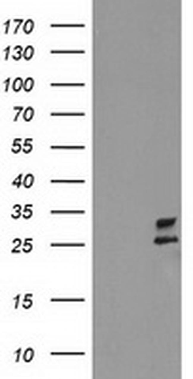CXorf26 Antibody in Western Blot (WB)