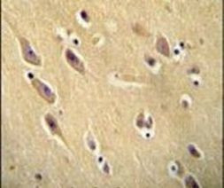 CYB561D1 Antibody in Immunohistochemistry (IHC)