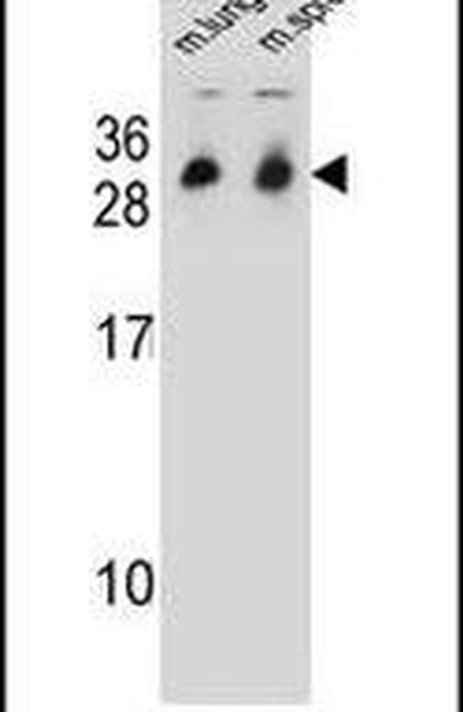 CYB561D1 Antibody in Western Blot (WB)