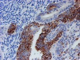 CYB5R1 Antibody in Immunohistochemistry (Paraffin) (IHC (P))