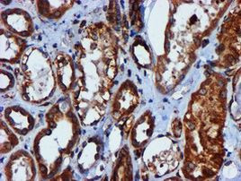 CYB5R3 Antibody in Immunohistochemistry (Paraffin) (IHC (P))