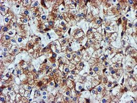 CYB5R3 Antibody in Immunohistochemistry (Paraffin) (IHC (P))