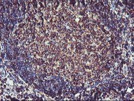 CYP2B6 Antibody in Immunohistochemistry (Paraffin) (IHC (P))