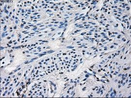 CYP2E1 Antibody in Immunohistochemistry (Paraffin) (IHC (P))