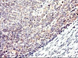 CYP2J2 Antibody in Immunohistochemistry (Paraffin) (IHC (P))