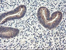 CYP2J2 Antibody in Immunohistochemistry (Paraffin) (IHC (P))