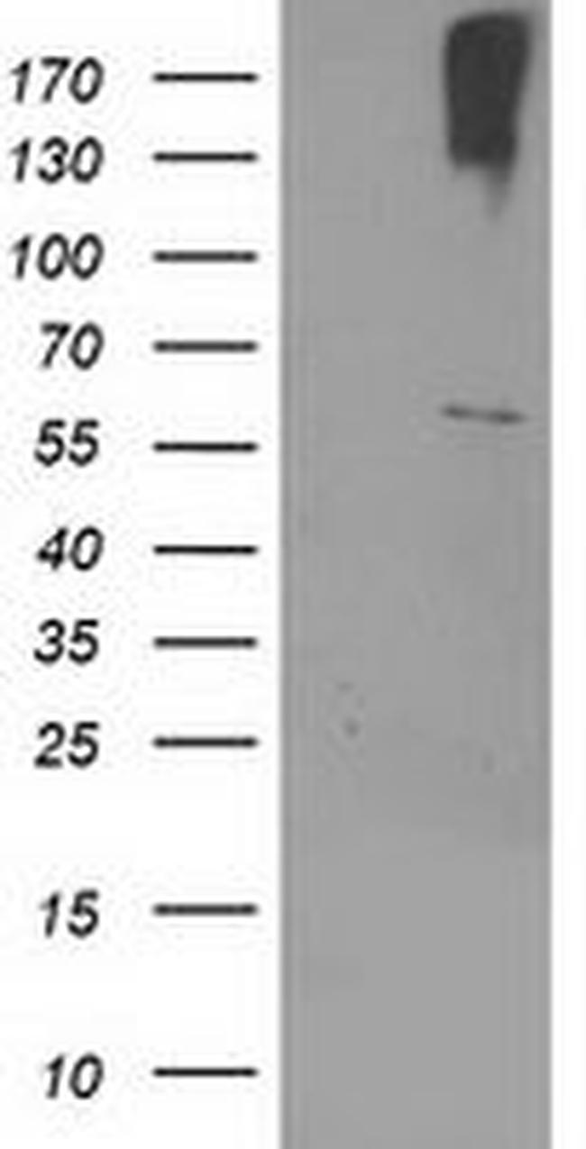 CYP2J2 Antibody in Western Blot (WB)