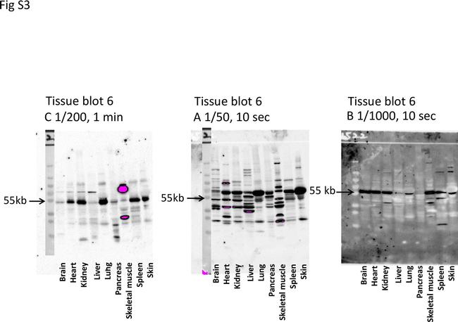 CYP2W1 Antibody in Western Blot (WB)