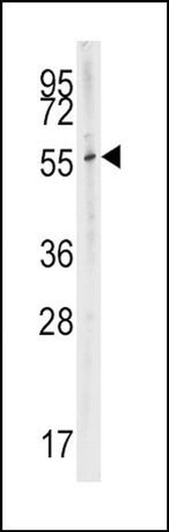 CYP2W1 Antibody in Western Blot (WB)