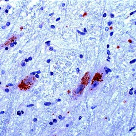 CaMKIV Antibody in Immunohistochemistry (IHC)