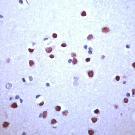 CaMKII alpha Antibody in Immunohistochemistry (IHC)