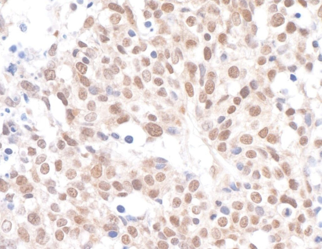 Caf1p150 Antibody in Immunohistochemistry (IHC)