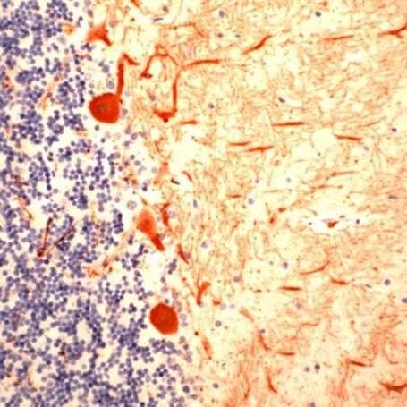 Calbindin D28K Antibody in Immunohistochemistry (IHC)