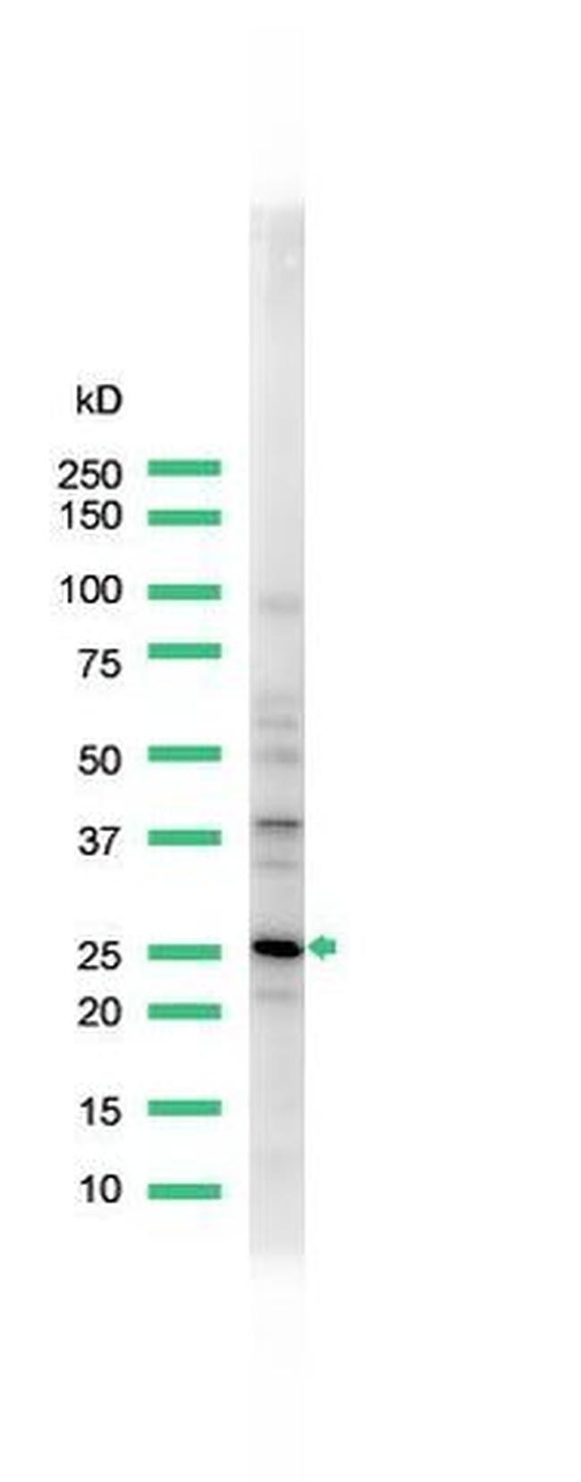 Calbindin D28K Antibody in Western Blot (WB)