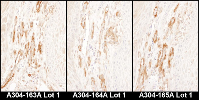 Caldesmon Antibody in Immunohistochemistry (IHC)