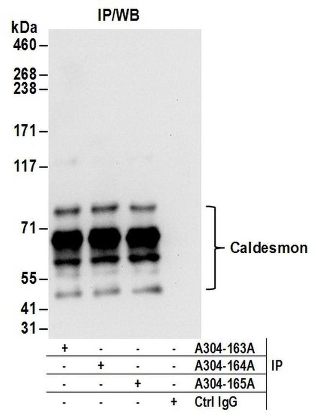 Caldesmon Antibody in Western Blot (WB)