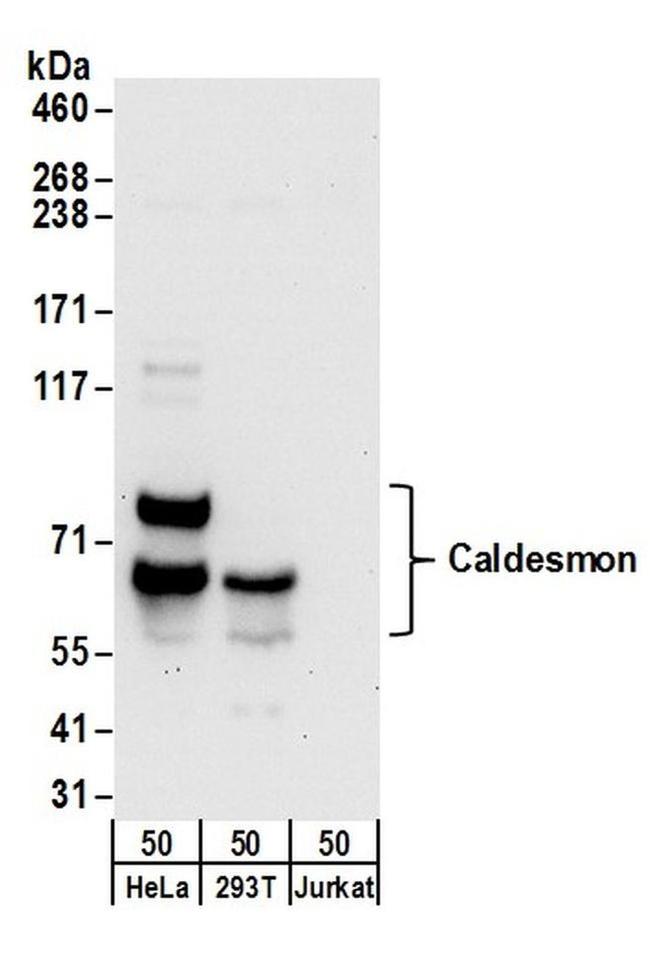 Caldesmon Antibody in Western Blot (WB)