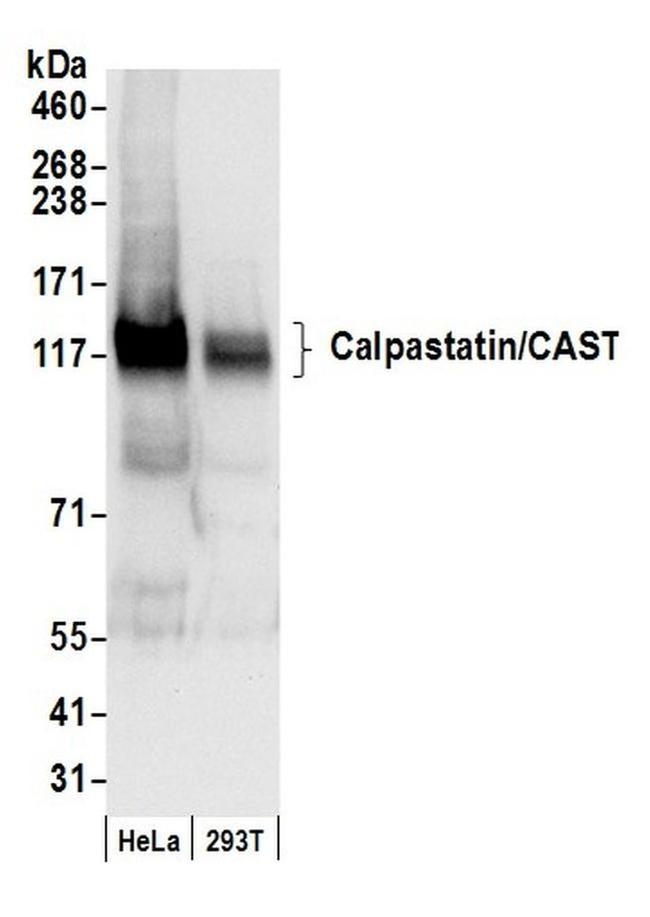 Calpastatin/CAST Antibody in Western Blot (WB)