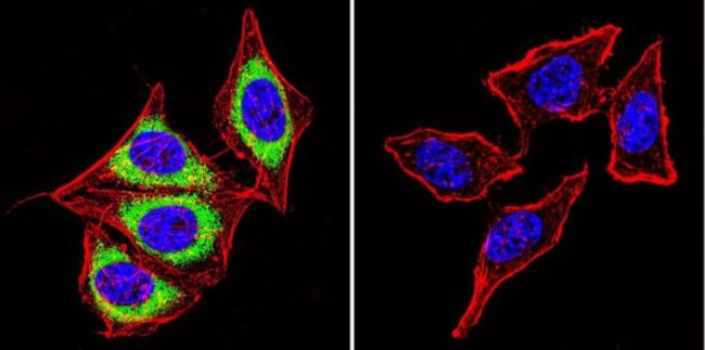 Calsequestrin Antibody in Immunocytochemistry (ICC/IF)