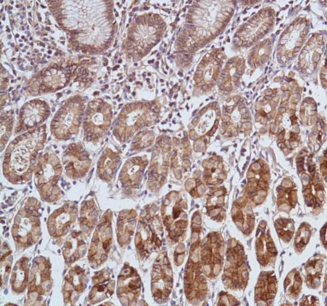 Carbonic Anhydrase IX Antibody in Immunohistochemistry (Paraffin) (IHC (P))