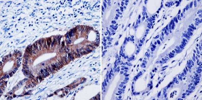 beta Catenin Antibody in Immunohistochemistry (Paraffin) (IHC (P))