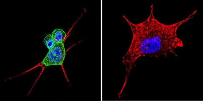 beta Catenin Antibody in Immunocytochemistry (ICC/IF)