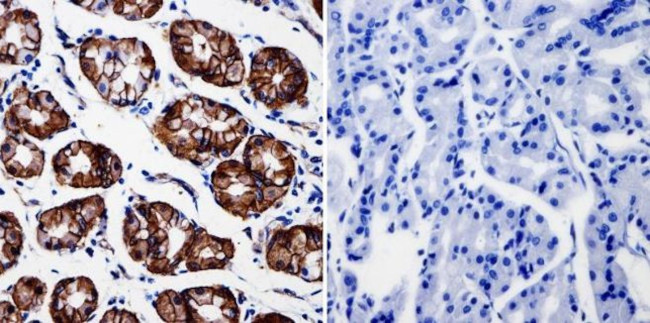 beta Catenin Antibody in Immunohistochemistry (Paraffin) (IHC (P))