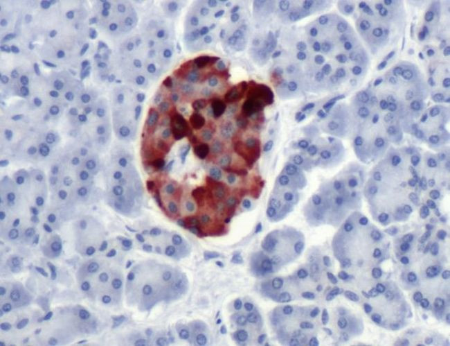 Chromogranin A Antibody in Immunohistochemistry (IHC)