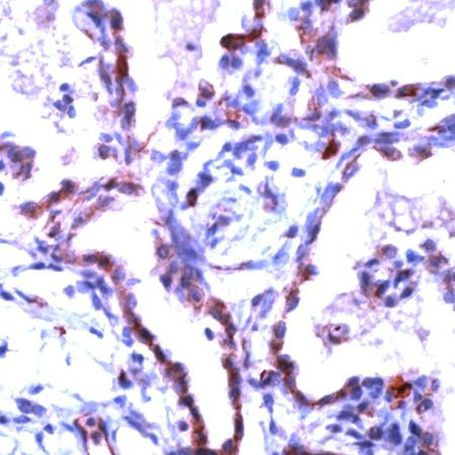 Claudin 5 Antibody in Immunohistochemistry (IHC)