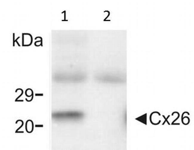 Connexin 26 Antibody in Western Blot (WB)